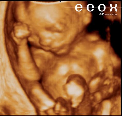 fotos do feto com 18 semanas